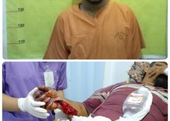 Aniaya Berat Dengan Kampak Hingga Bersimbah Darah, Pria Ini Ditahan Polsek Sinaboi